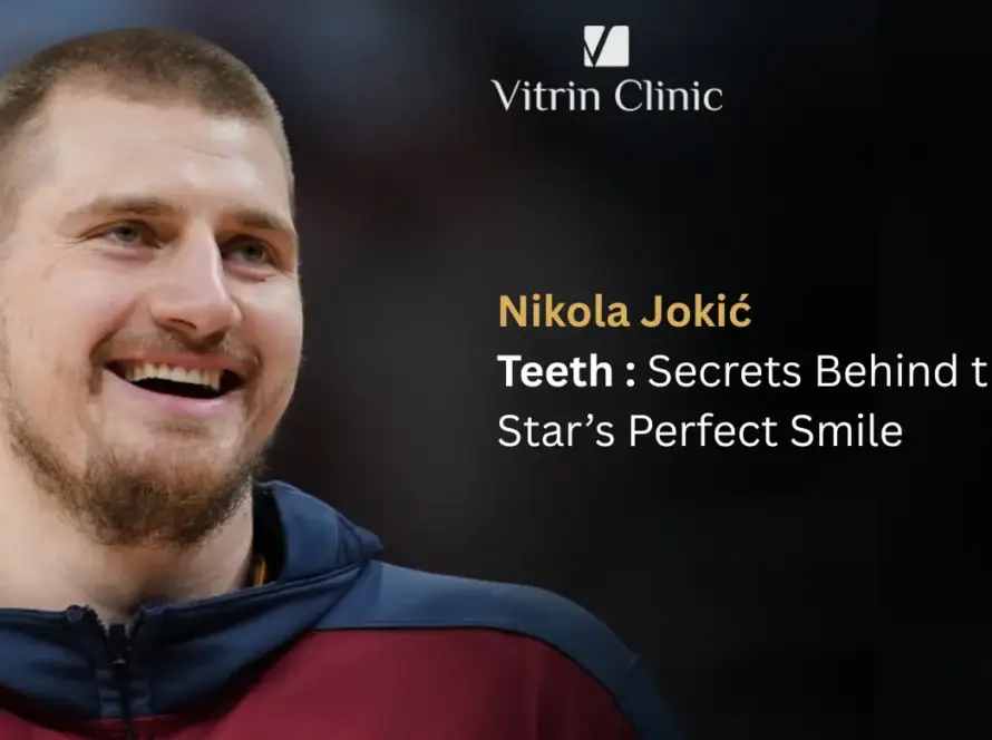 Nikola Jokić Teeth