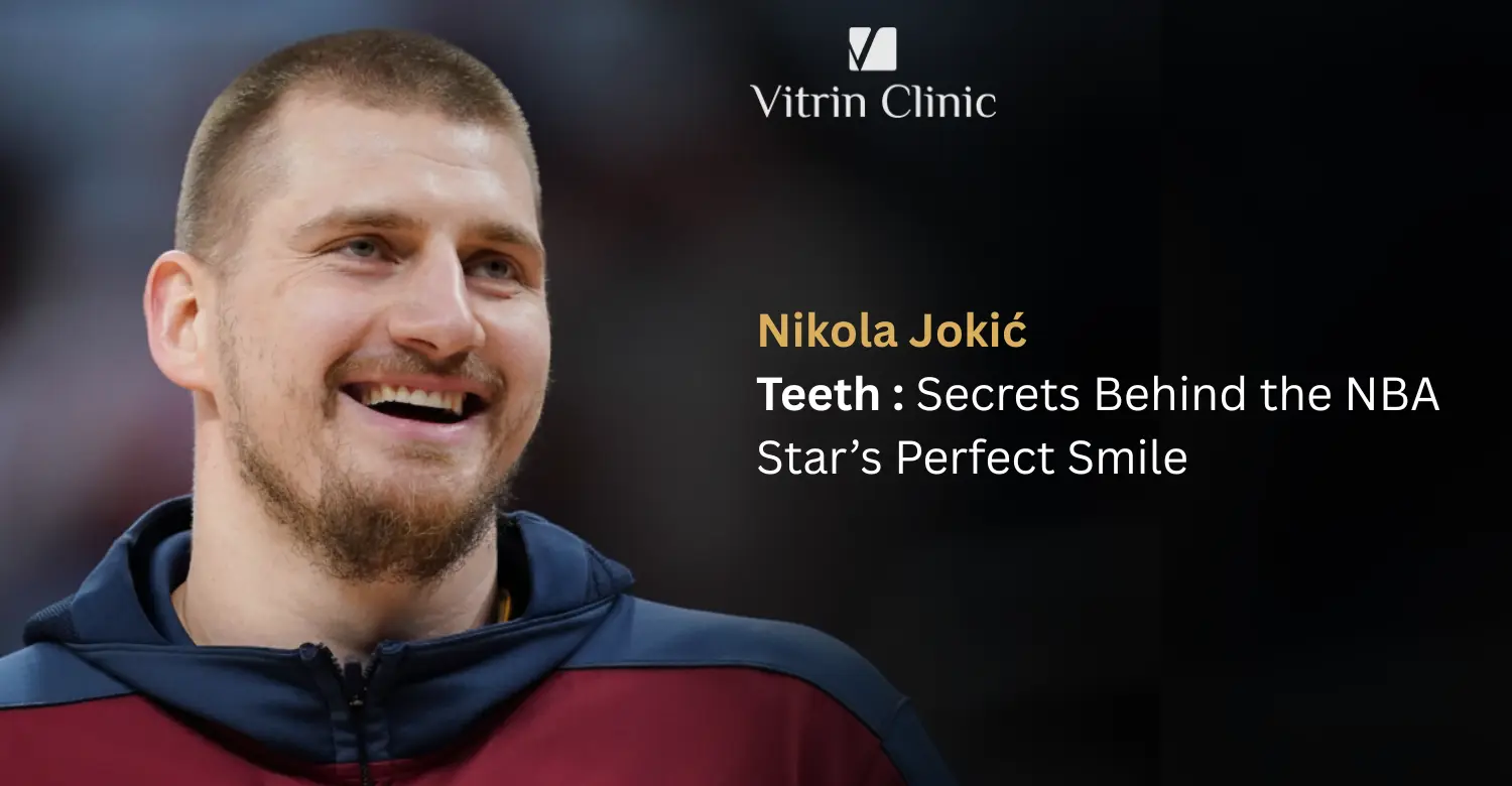 Nikola Jokić Teeth