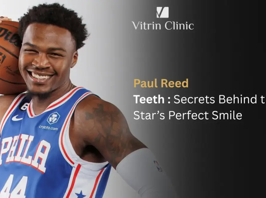 Paul Reed Teeth