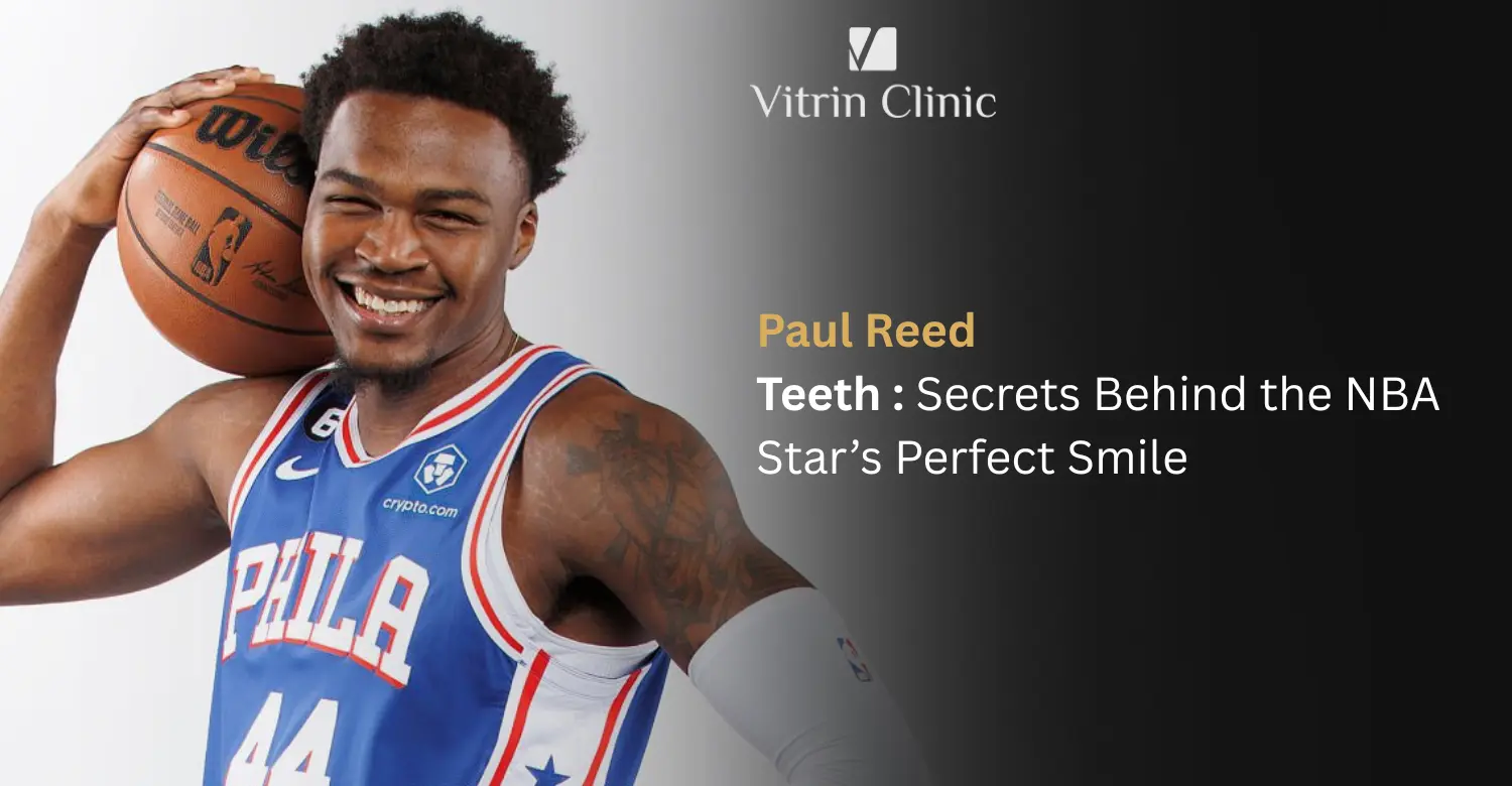 Paul Reed Teeth