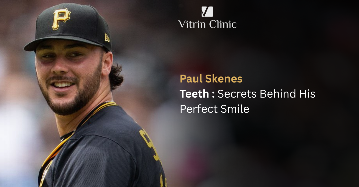 Paul Skenes Teeth: The Story Behind His Iconic Smile