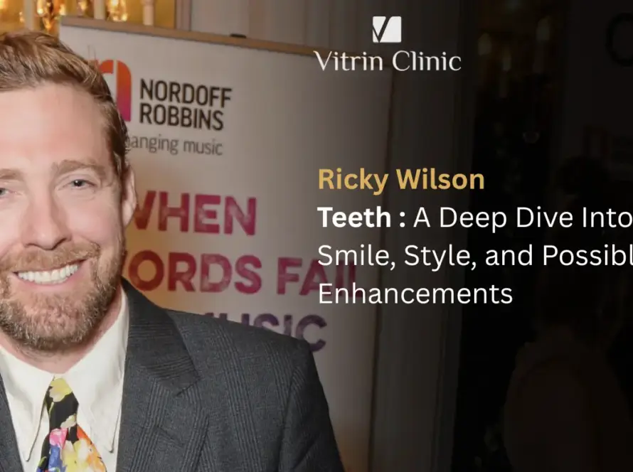 Ricky Wilson Teeth