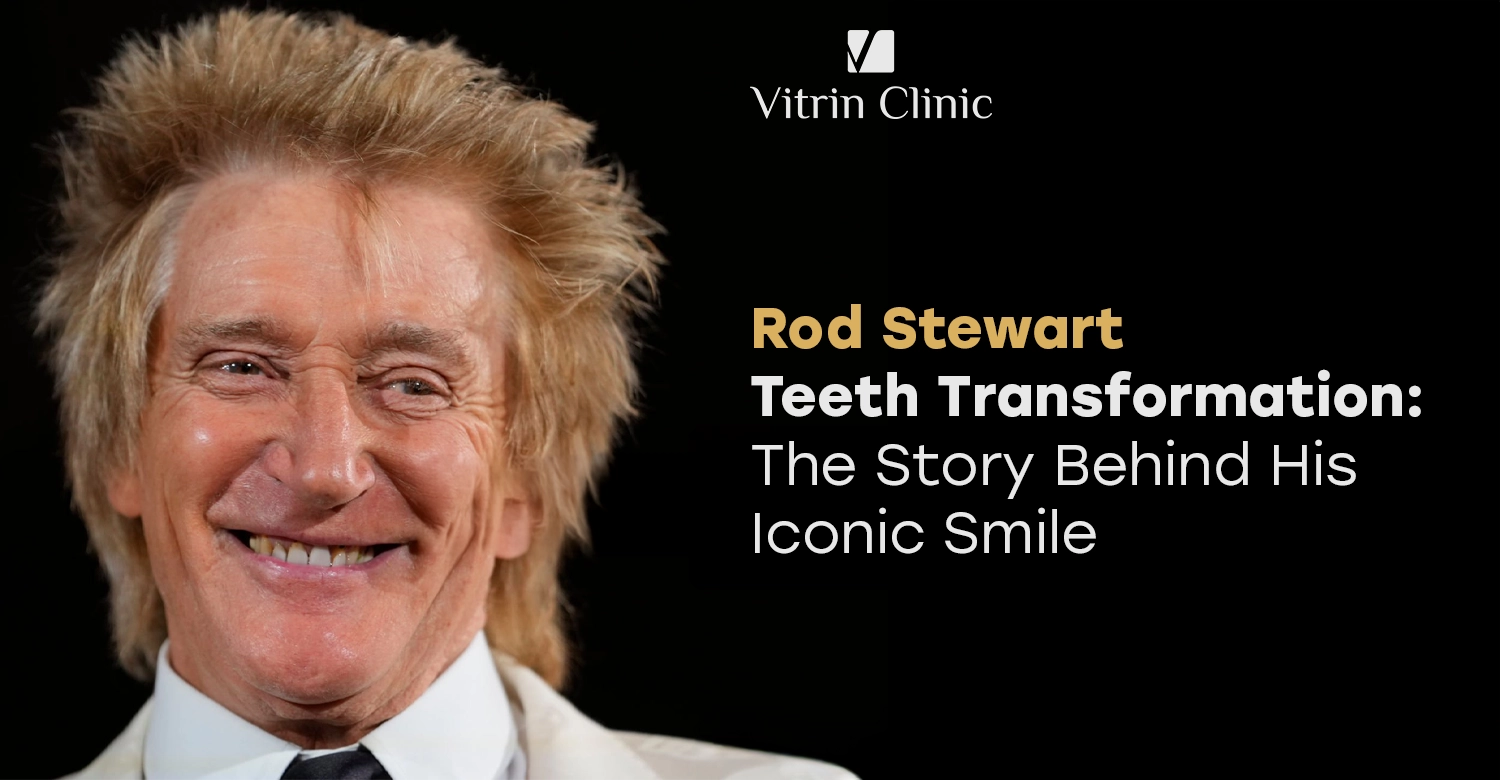 Rod Stewart teeth Transformation