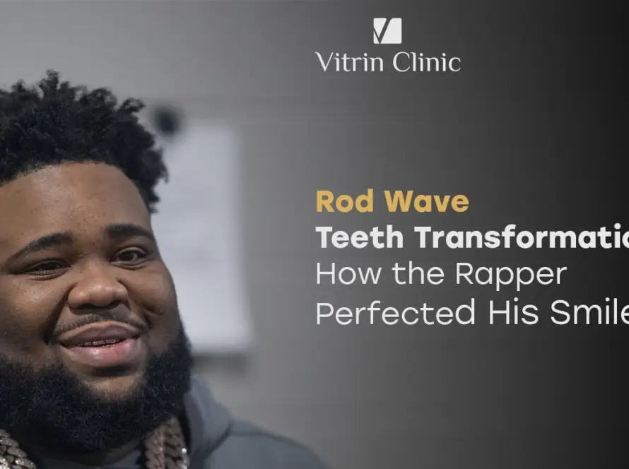 Rod Wave Teeth Transformation: How the Rapper Perfected His Smile