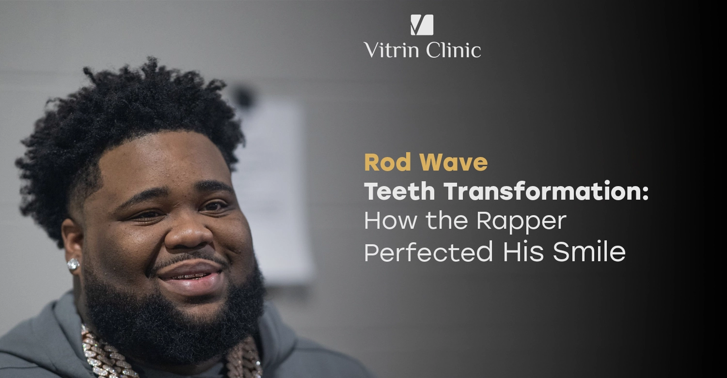 Rod Wave Teeth Transformation: How the Rapper Perfected His Smile