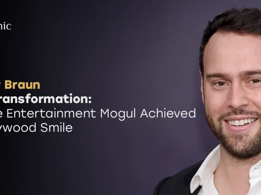 Scooter Braun Teeth Transformation