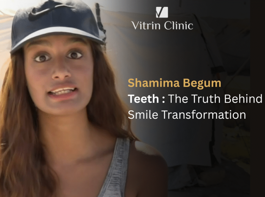 Shamima Begum Teeth