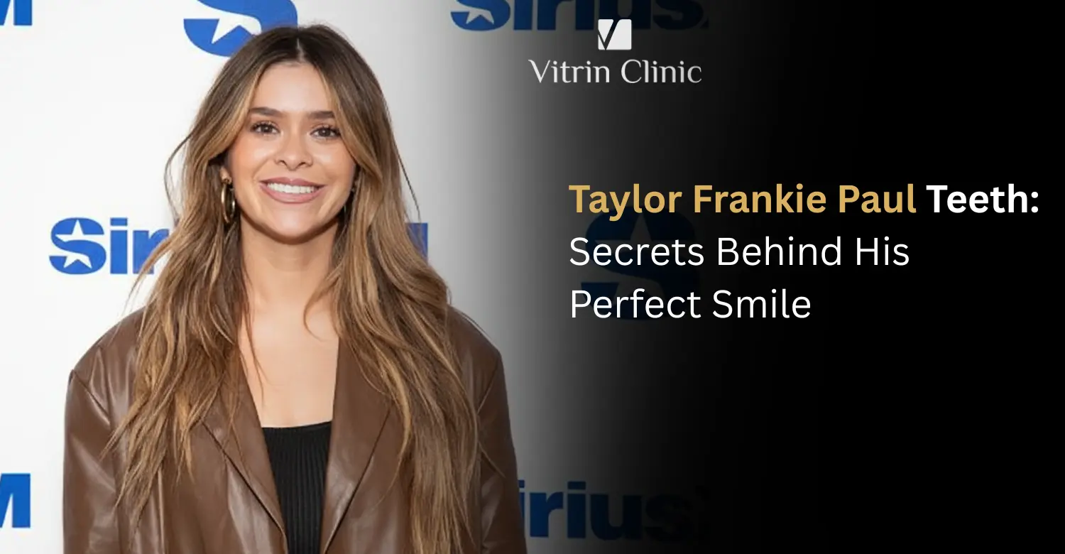 Taylor Frankie Paul Teeth