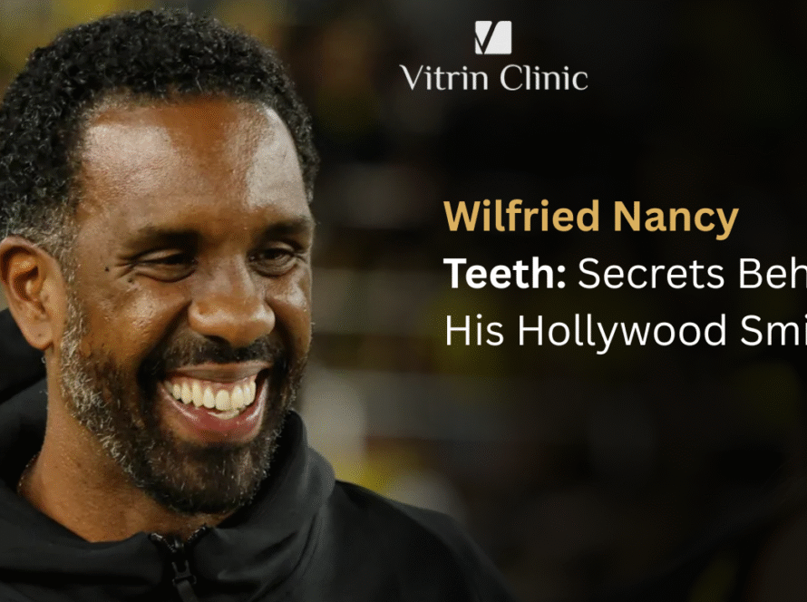 Wilfried Nancy Teeth