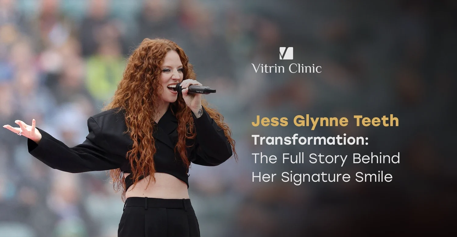 Jess Glynne Teeth Transformation: Before & After