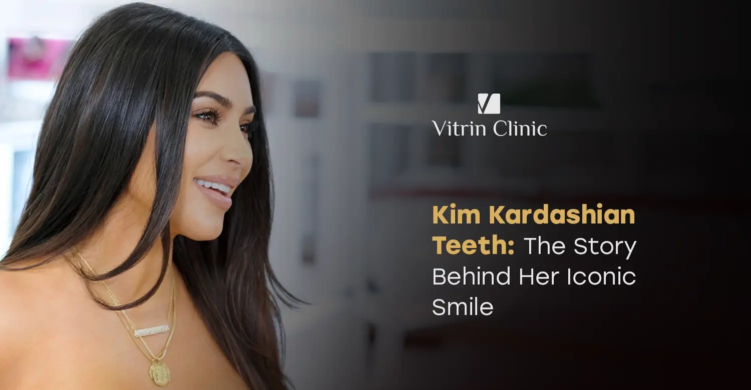 Kim Kardashian Teeth