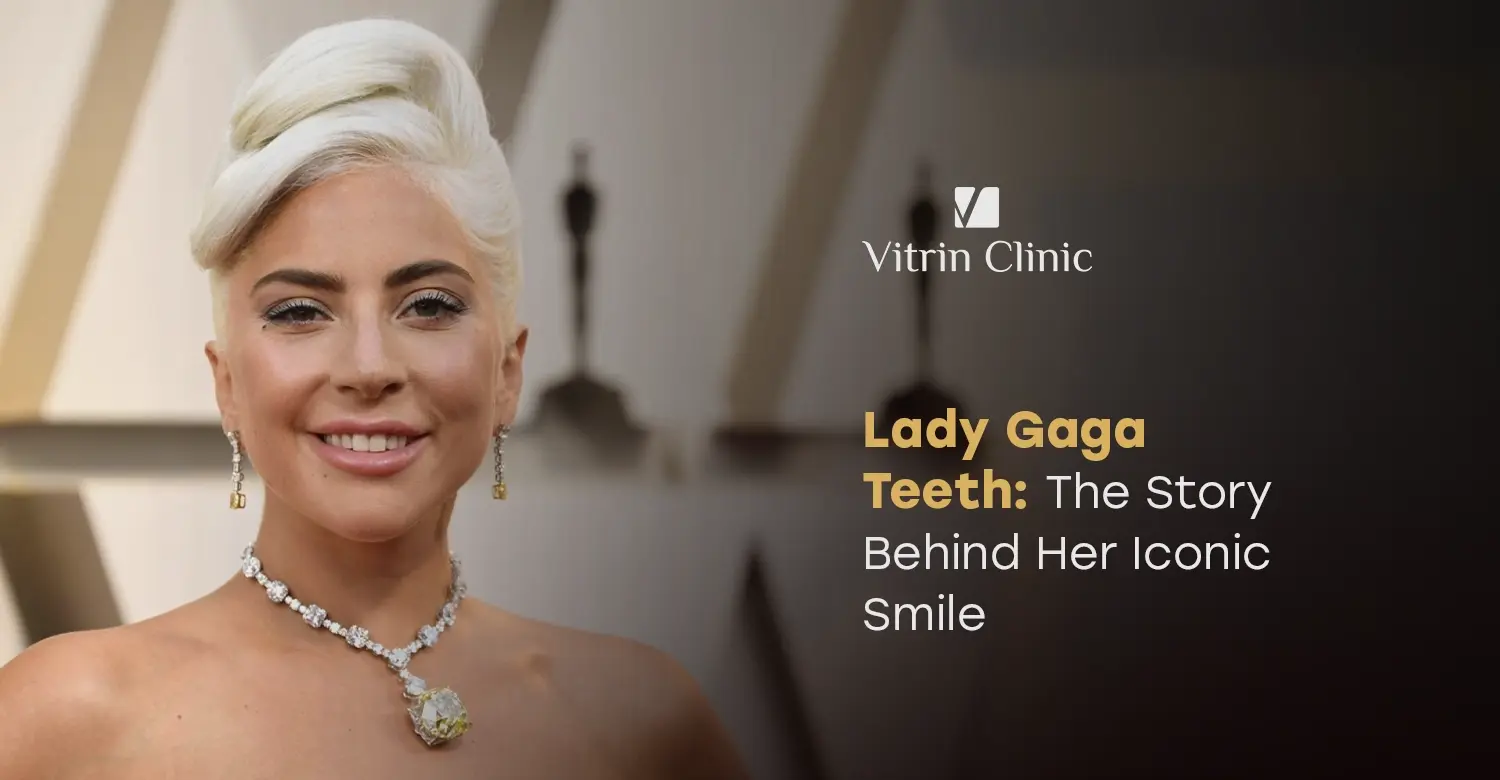 Lady Gaga Teeth