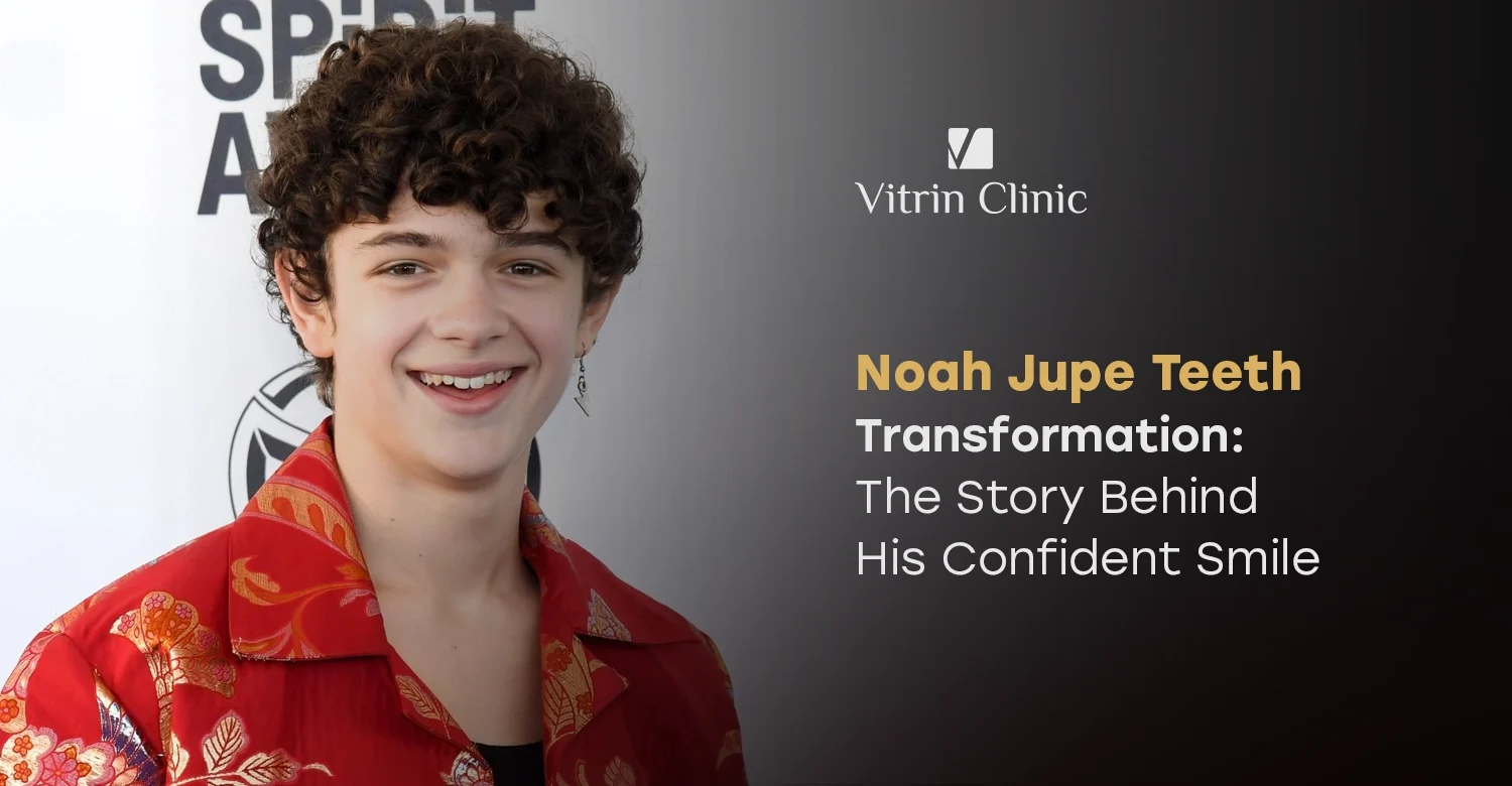 Noah Jupe Teeth Transformation