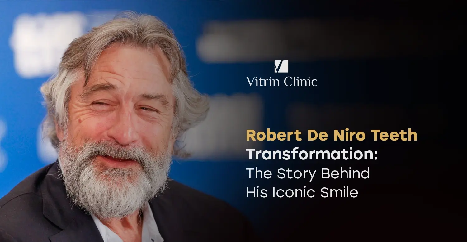 Robert De Niro Teeth Transformation