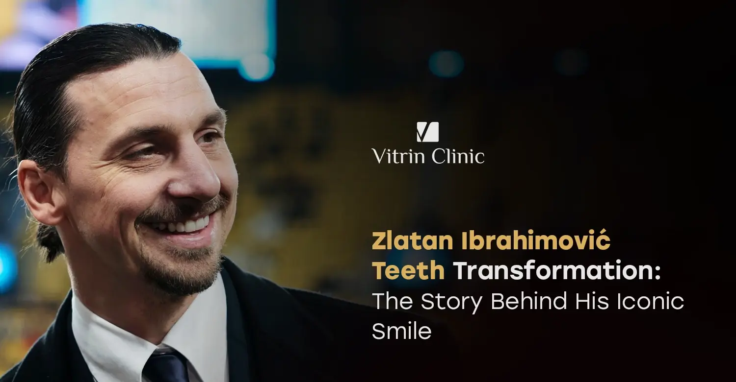 Zlatan Ibrahimović Teeth