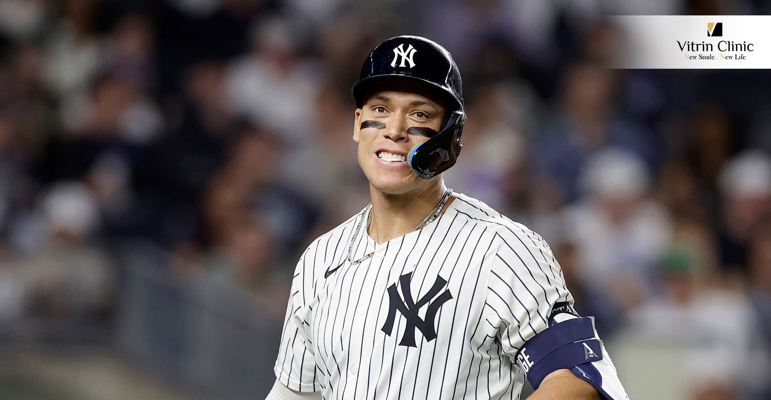Aaron Judge teeth