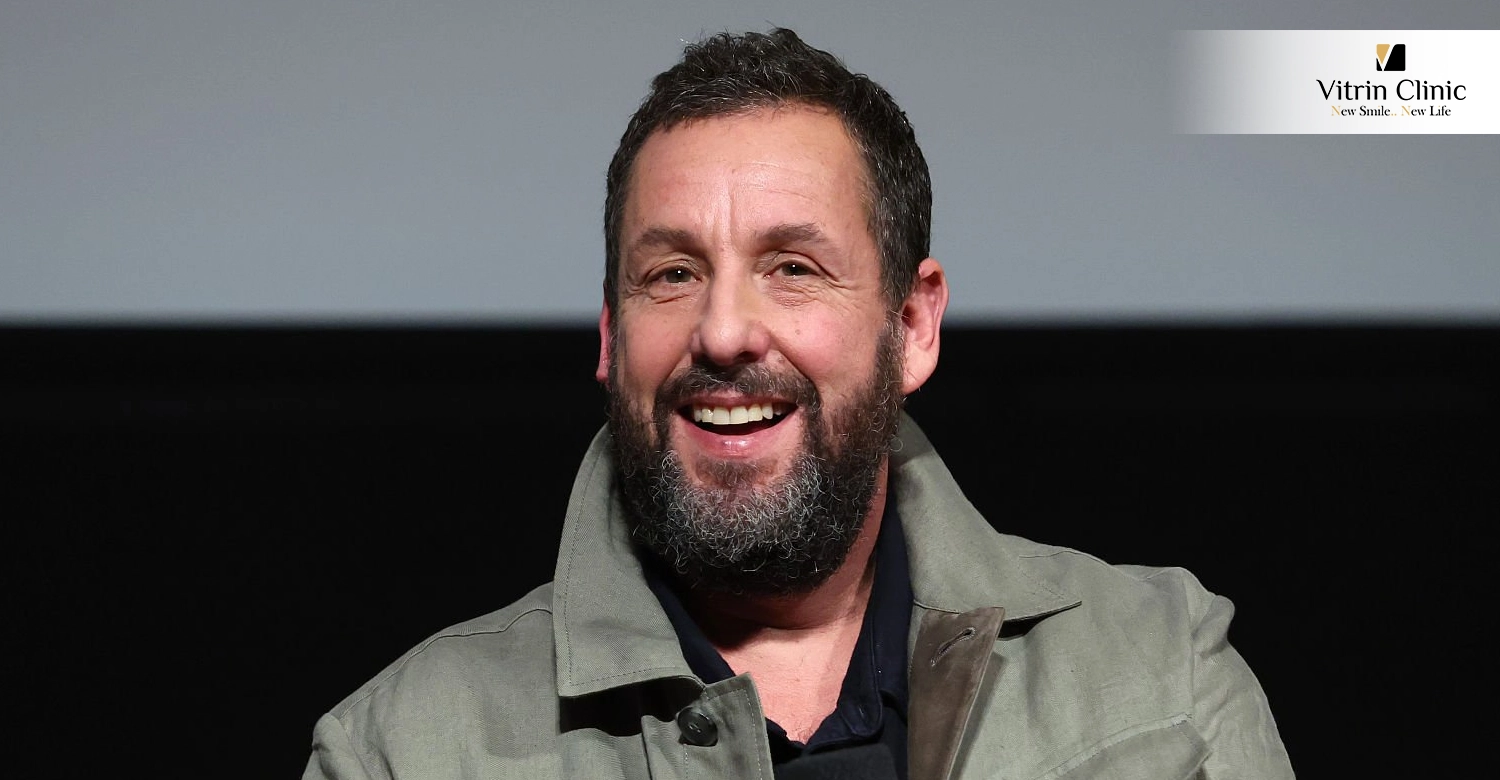 Adam Sandler teeth