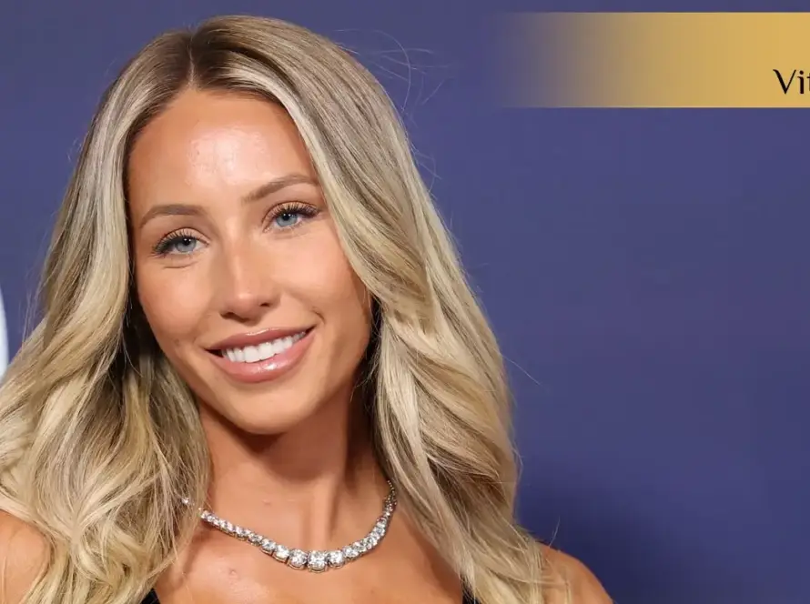 Alix Earle Teeth Transformation