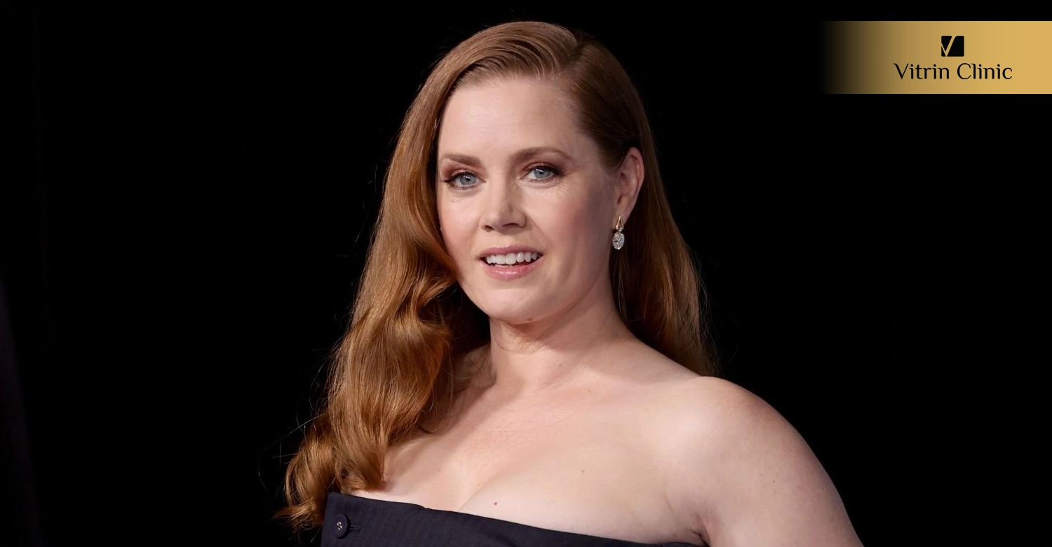 What Is the Public Reaction to Amy Adams' Smile Transformation?