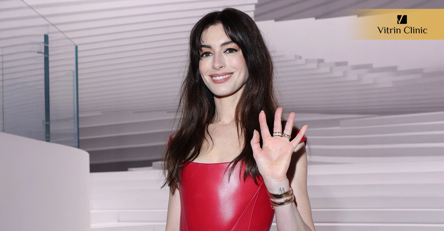 What Can We Learn from Anne Hathaway's Smile Transformation?