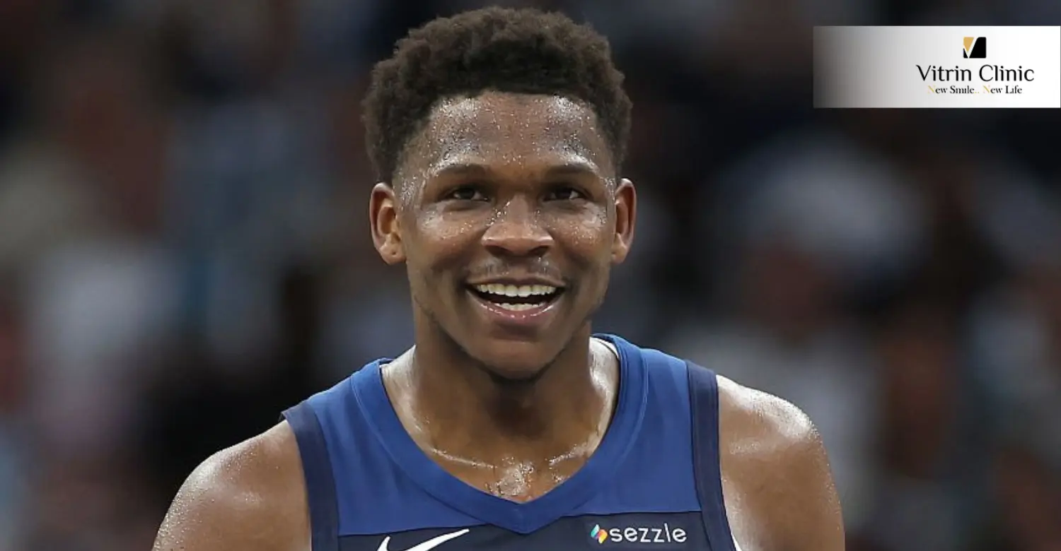 Anthony Edwards teeth