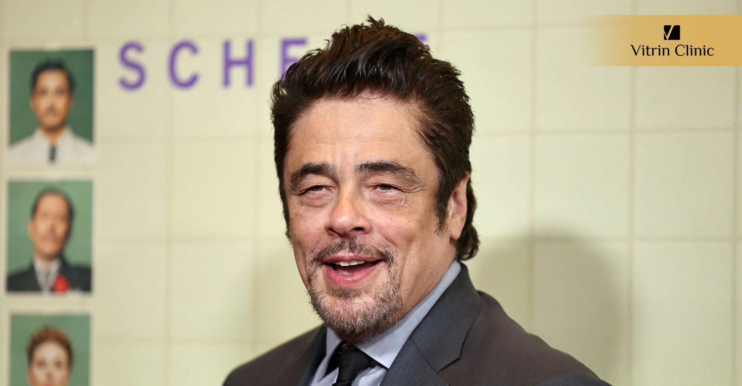 Dental Procedures to Recreate a Benicio del Toro-Inspired Smile