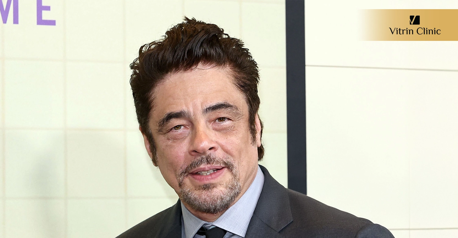Did Benicio del Toro Get Veneers or Cosmetic Dental Work?