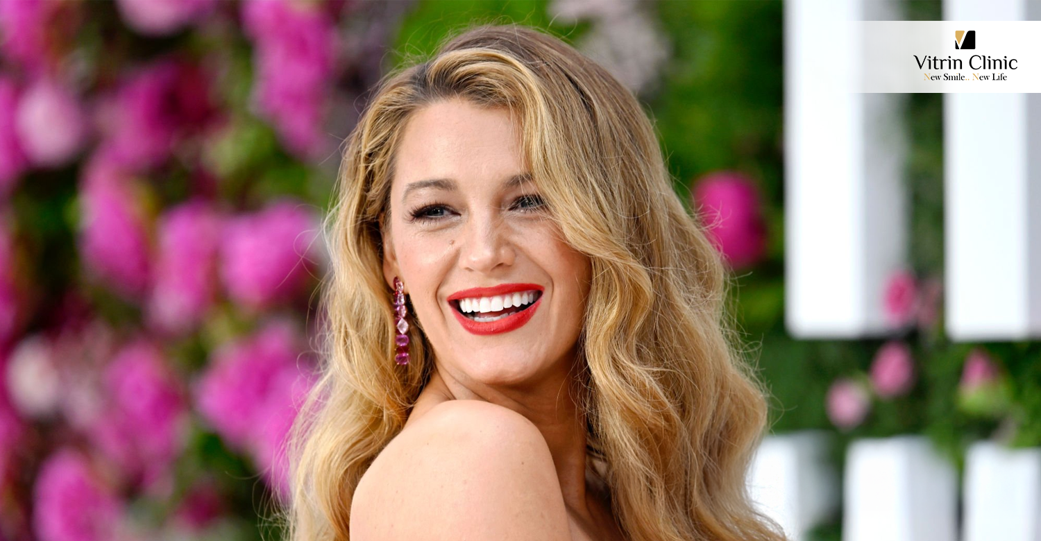 Blake Lively teeth