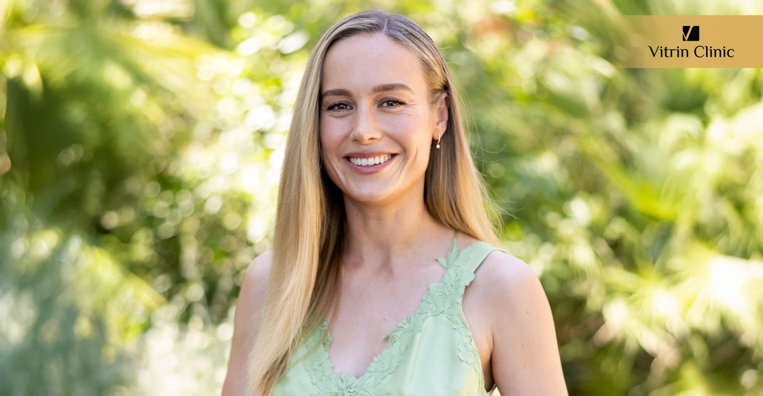 What Is the Public Reaction to Brie Larson's Smile Transformation?