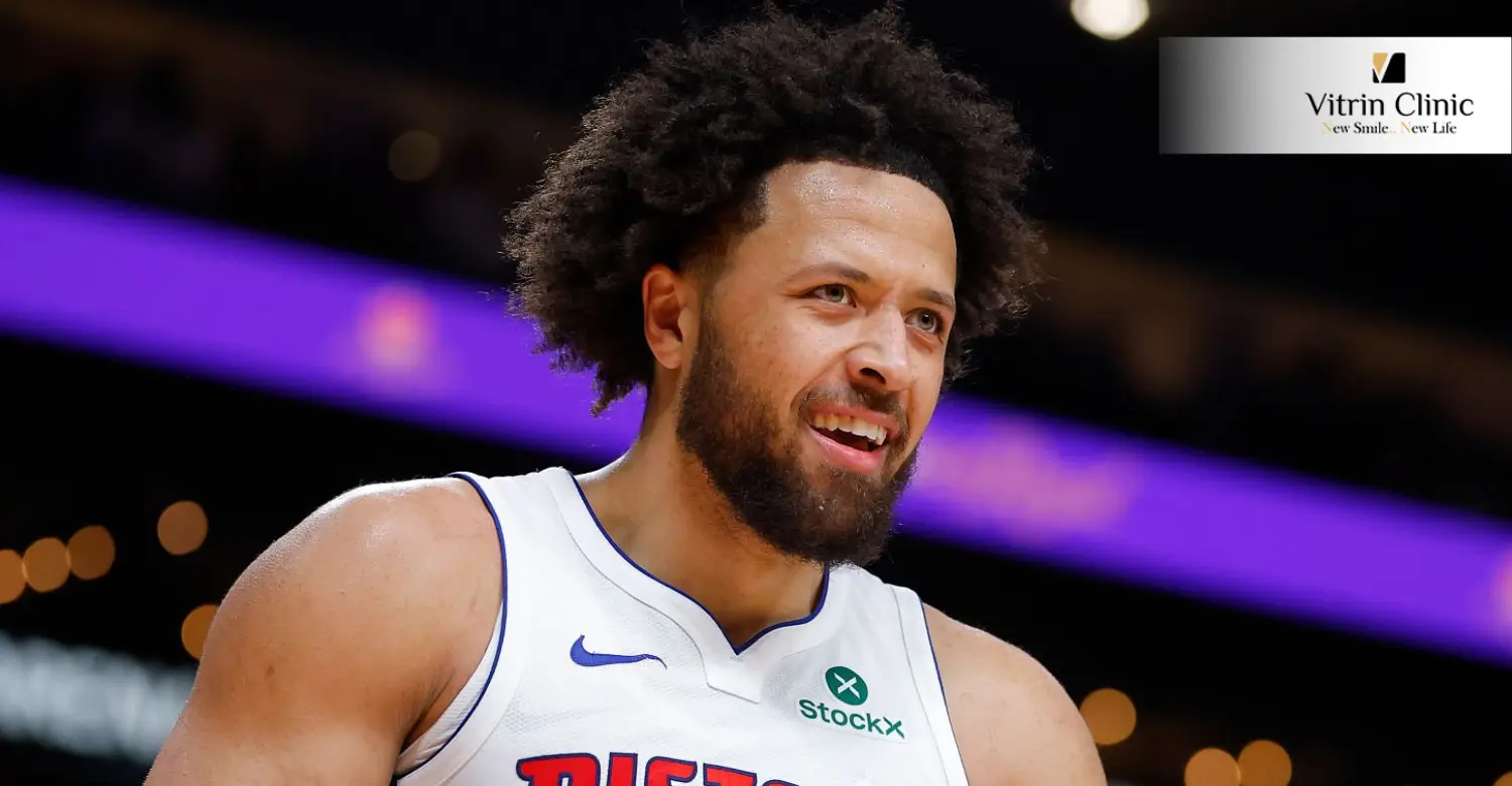 Cade Cunningham teeth