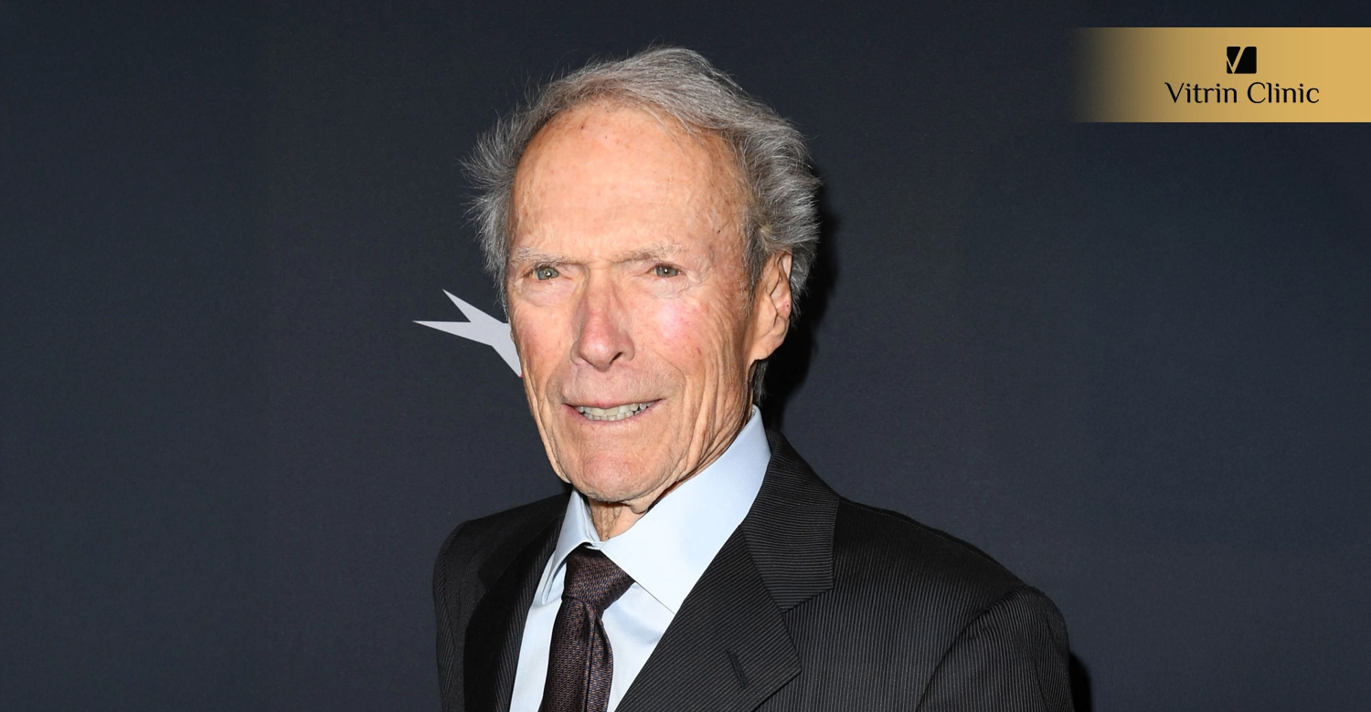 Did Clint Eastwood Get Veneers or Cosmetic Dental Work?