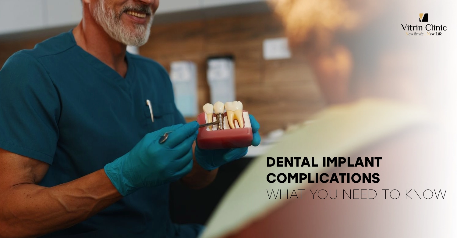 Dental Implant Complications