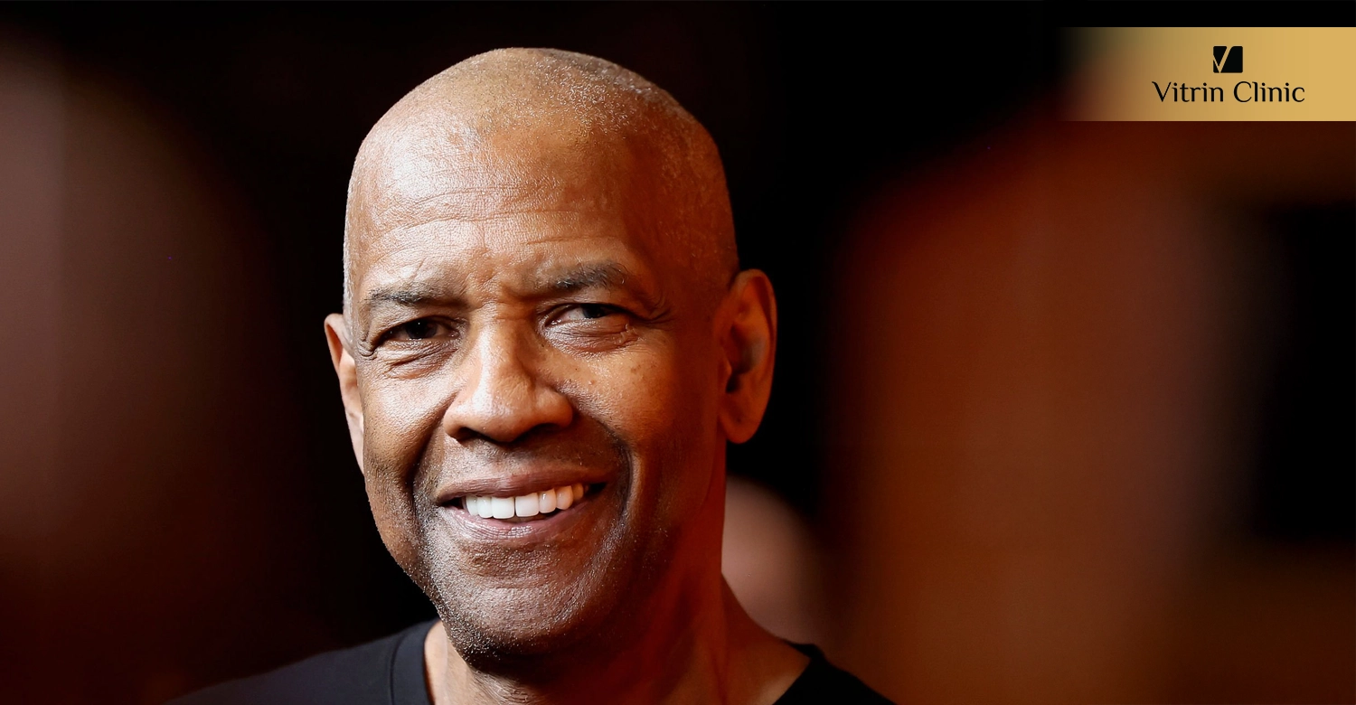 Signs of Professional Dental Work in Denzel Washington's Smile