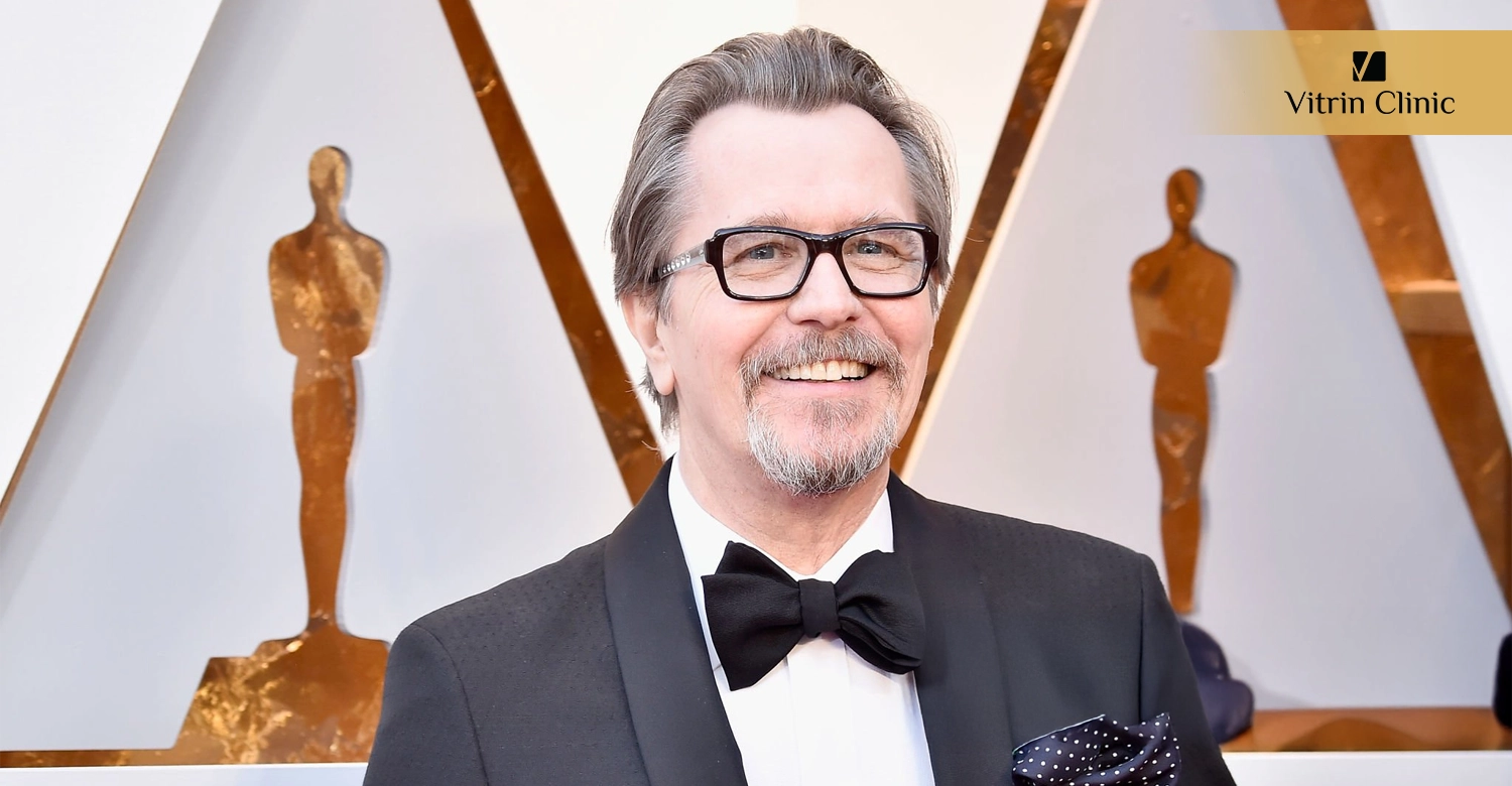 Signs of Professional Dental Work in Gary Oldman's Smile