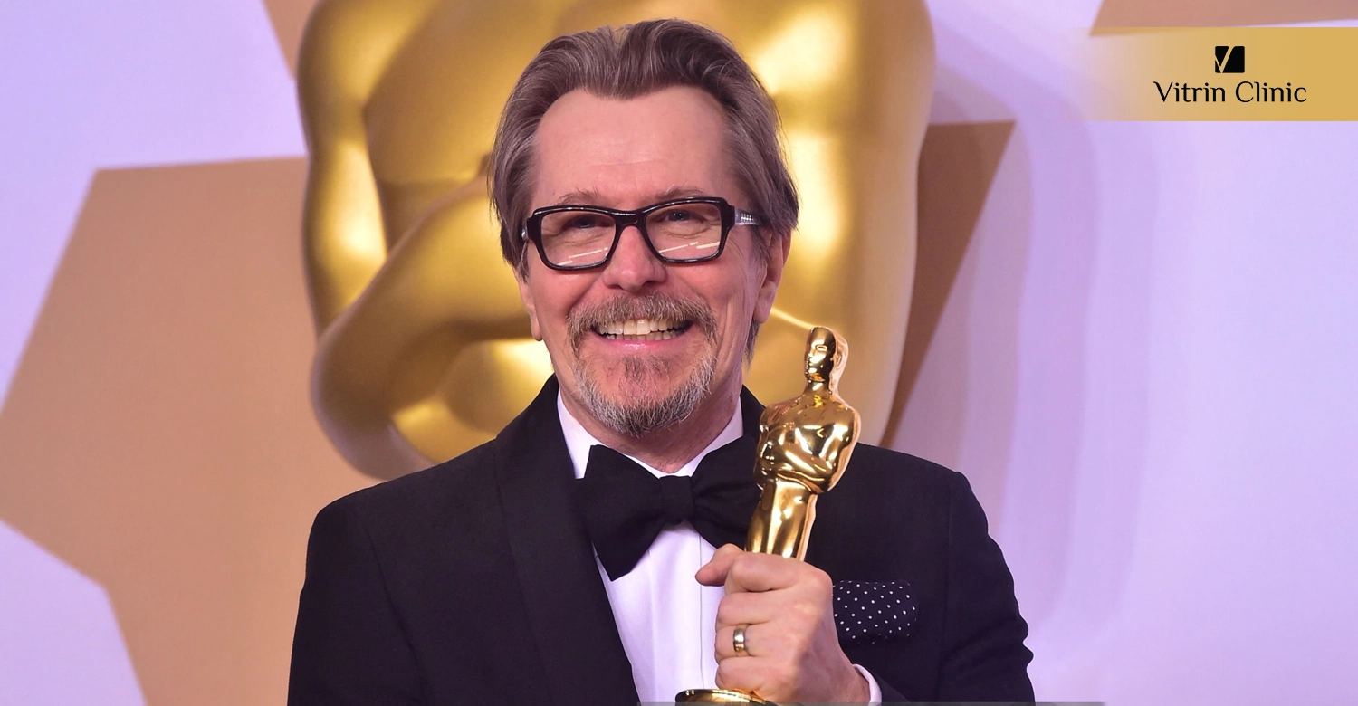 Gary Oldman Teeth