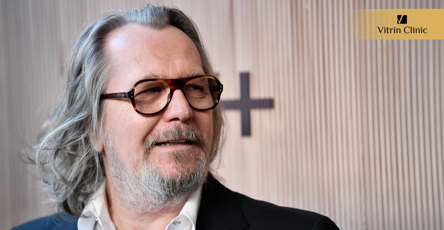 Did Gary Oldman Get Veneers or Cosmetic Dental Work?