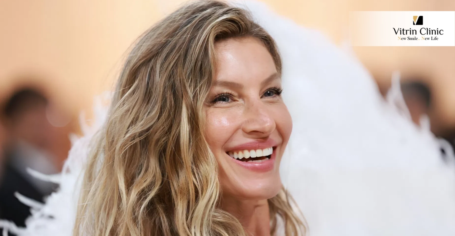 Gisele Bündchen Teeth
