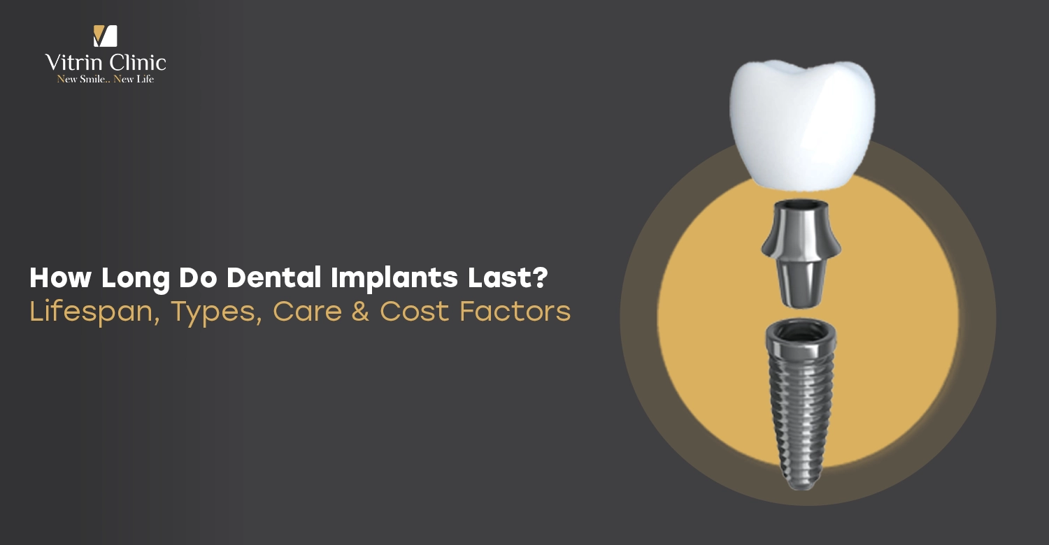 how long dental implants last