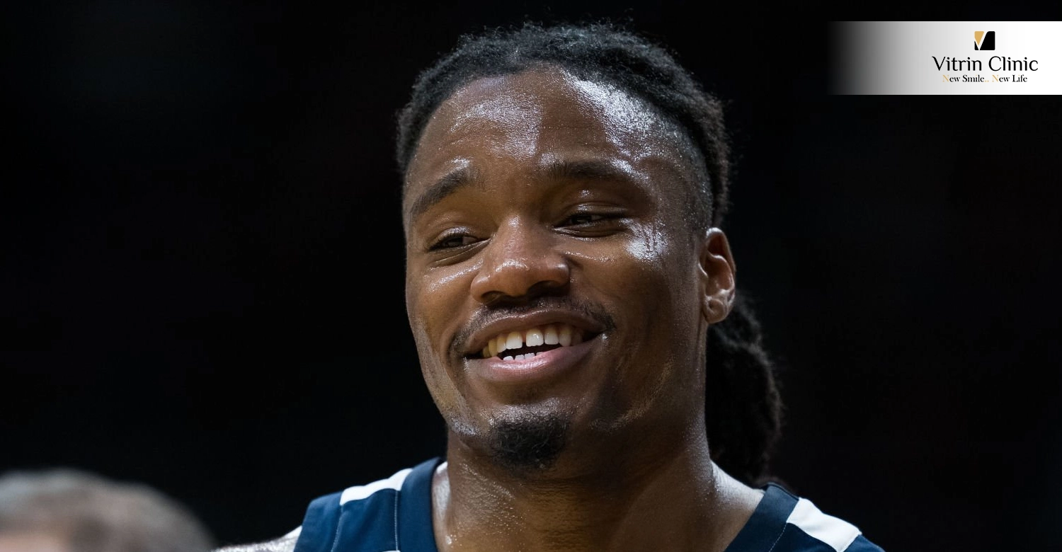 Jahmyl Telfort Teeth