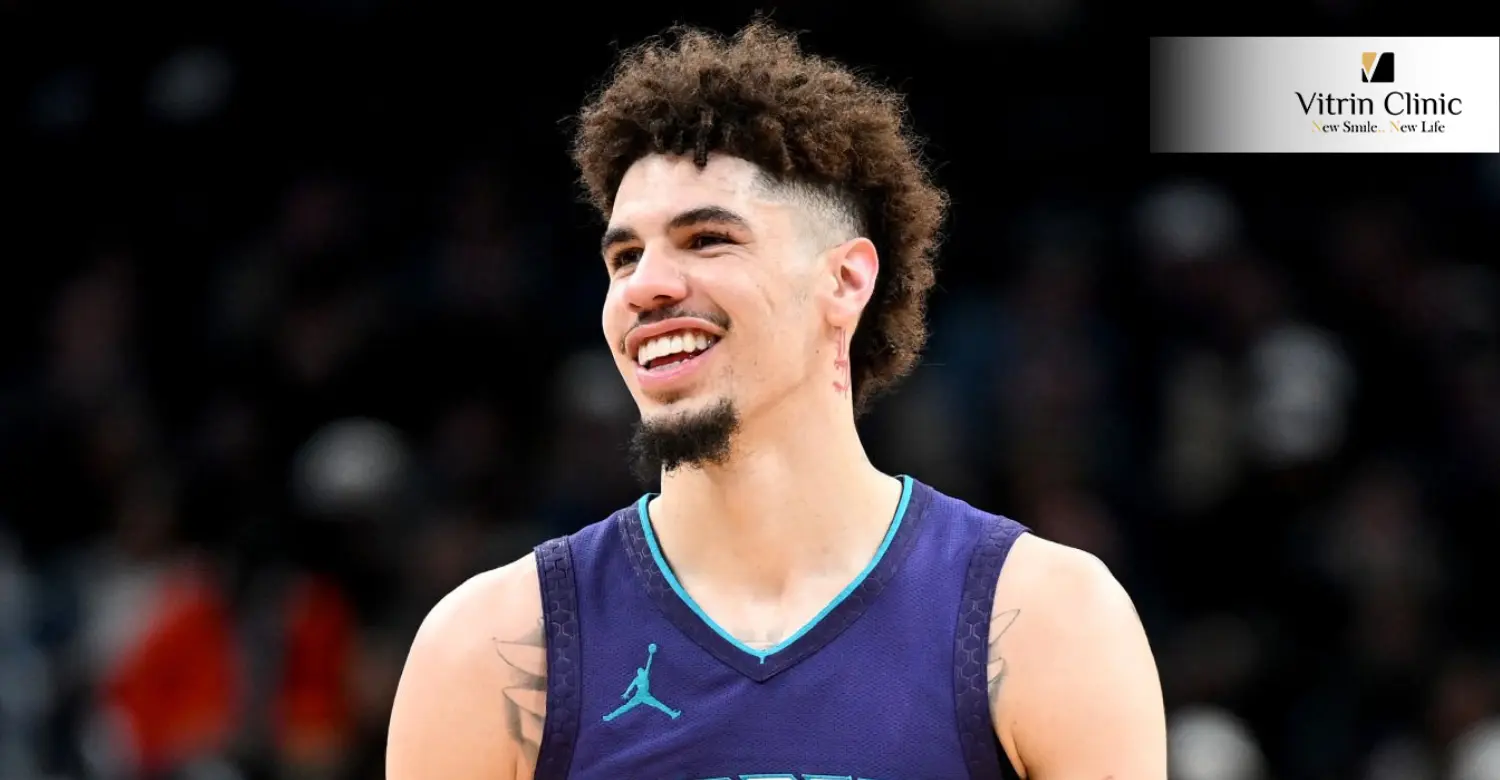 LaMelo Ball teeth