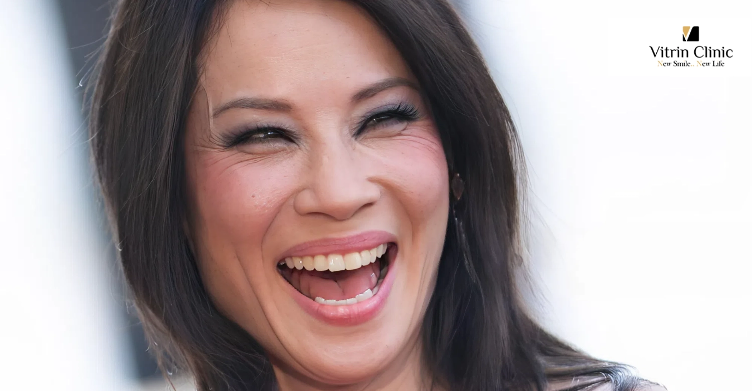 Lucy Liu teeth