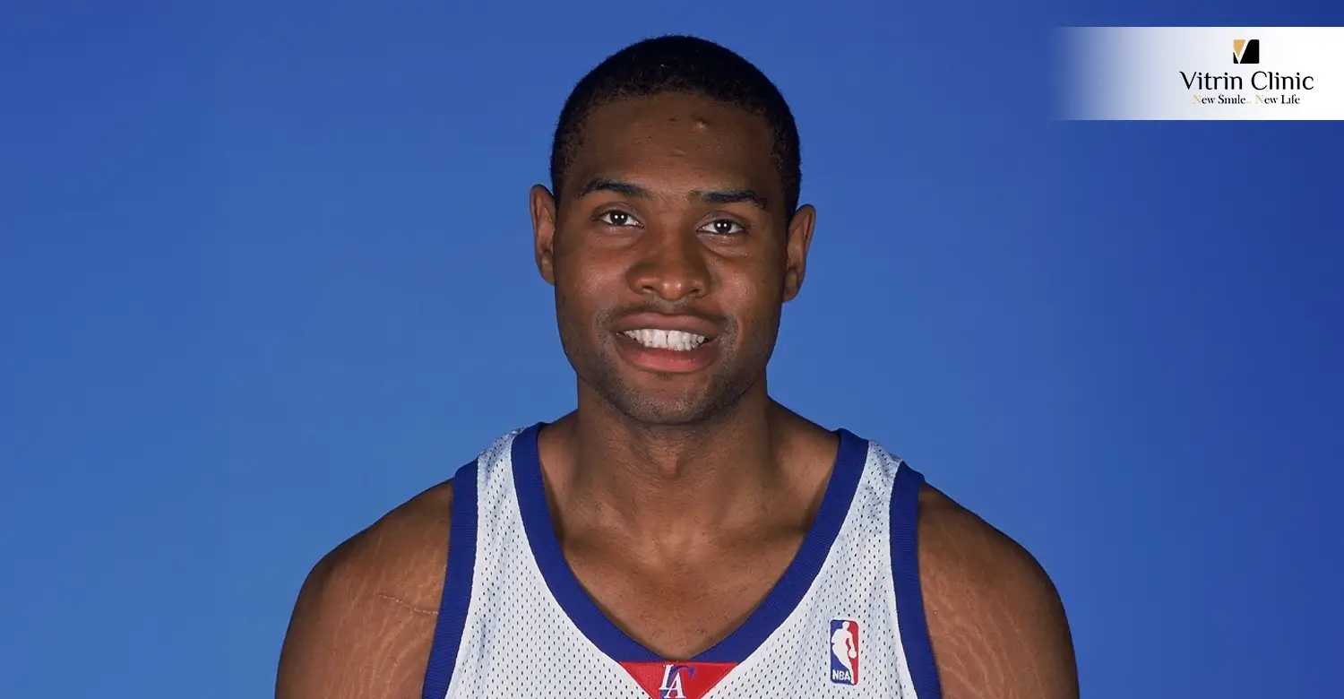 Michael Olowokandi Teeth