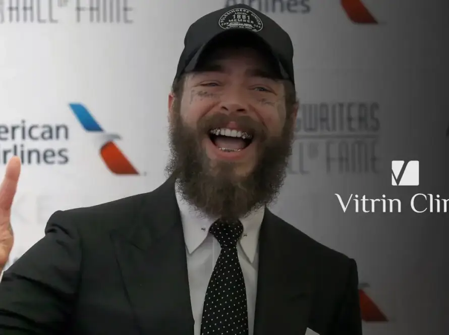 Post Malone Teeth