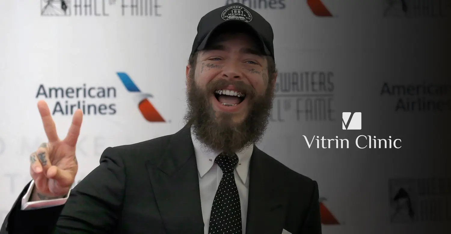 Post Malone Teeth
