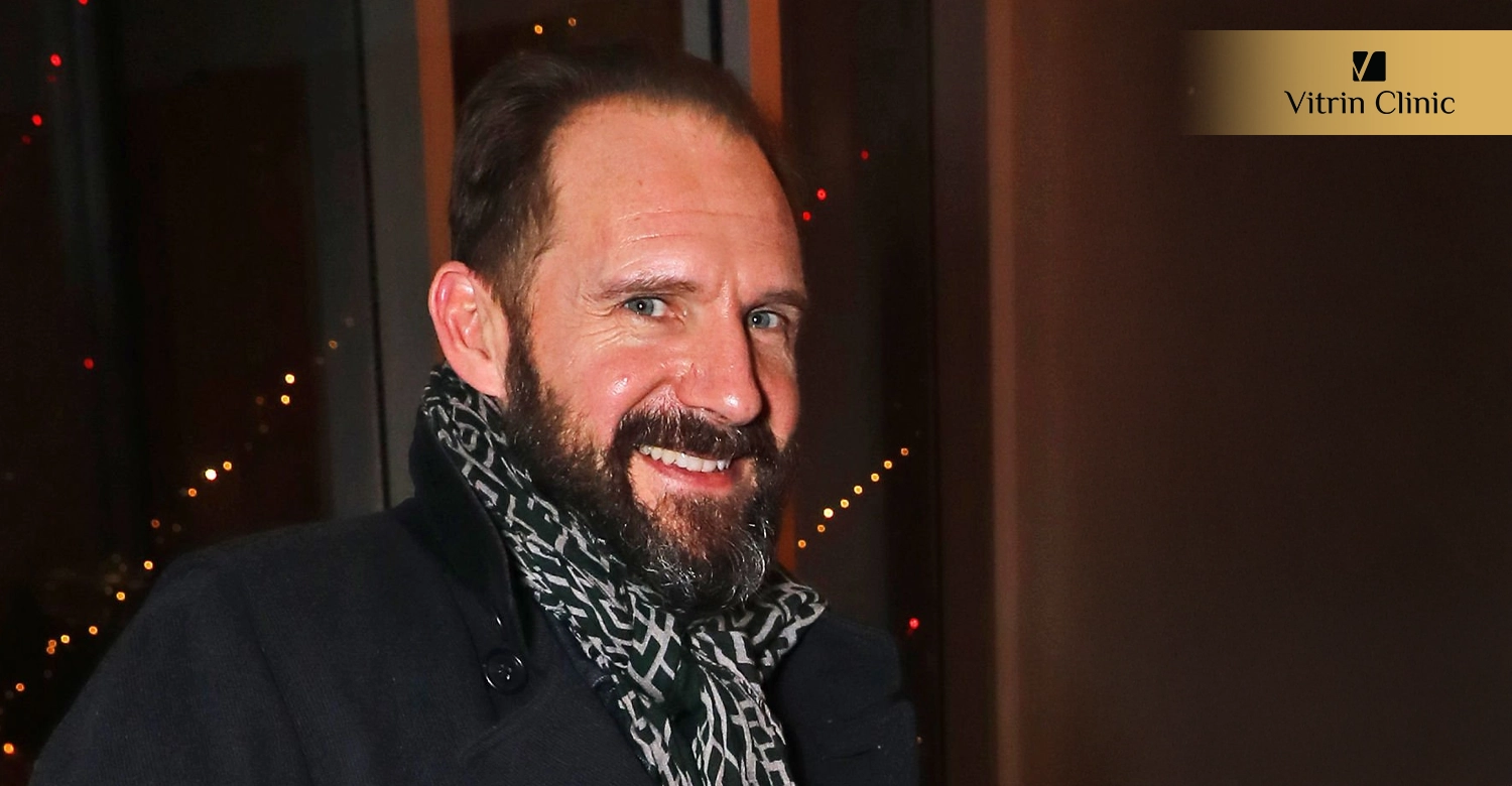 Did Ralph Fiennes Get Veneers or Cosmetic Dental Work?