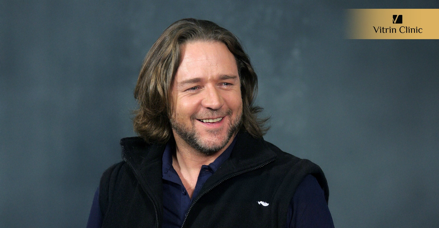 How Smile Aesthetics Enhance Russell Crowe's Public Image