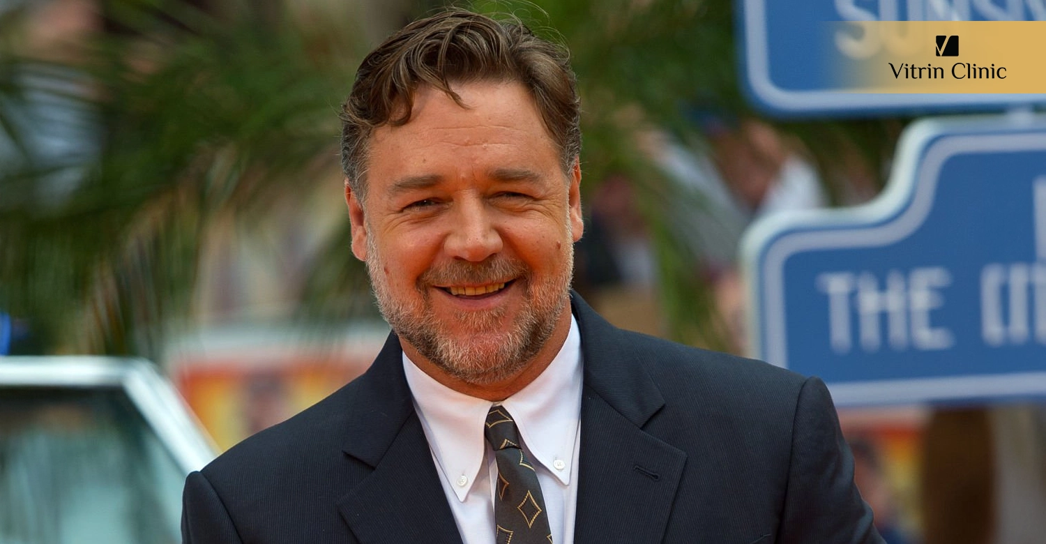 Is Russell Crowe Sporting a Hollywood Smile?