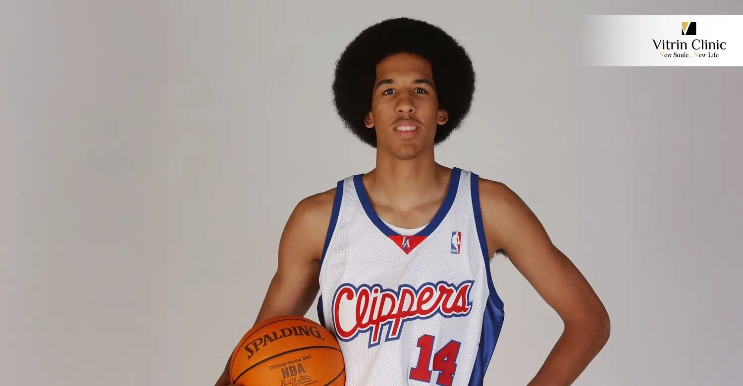 Shaun Livingston Teeth