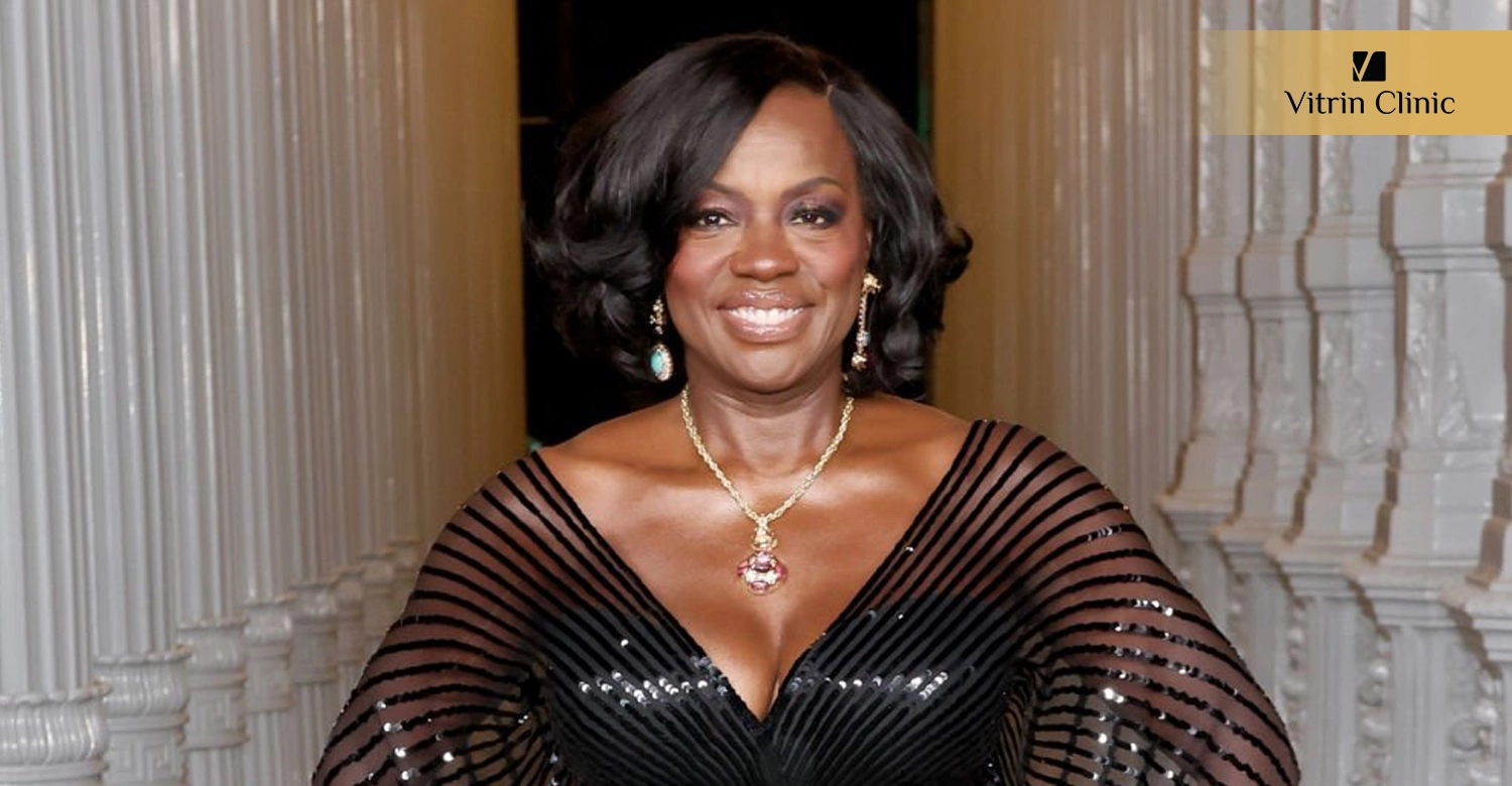 How to Get a Smile Like "Viola Davis Smile" at Vitrinclinic in Turkey?