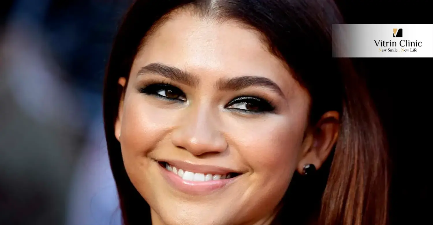 Signs of Professional Dental Work in Zendaya's Smile